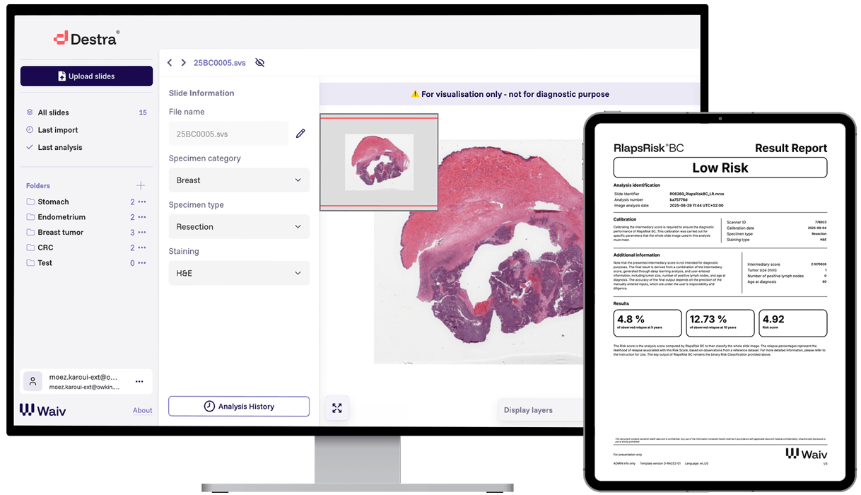 RlapsRisk: Next-generation AI testing from routine H&E to inform the treatment pathway for early breast cancer patients