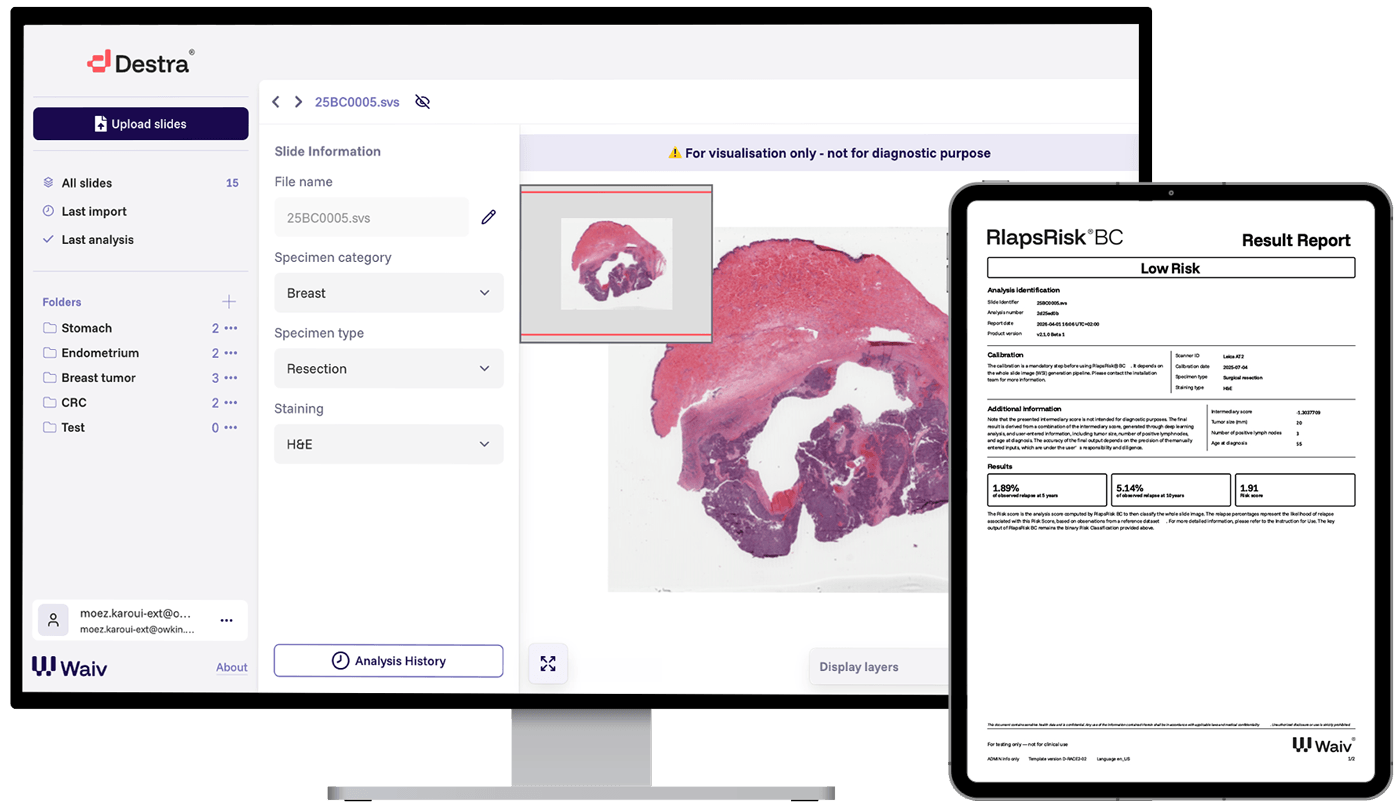 RlapsRisk: Next-generation AI testing from routine H&E to inform the treatment pathway for early breast cancer patients