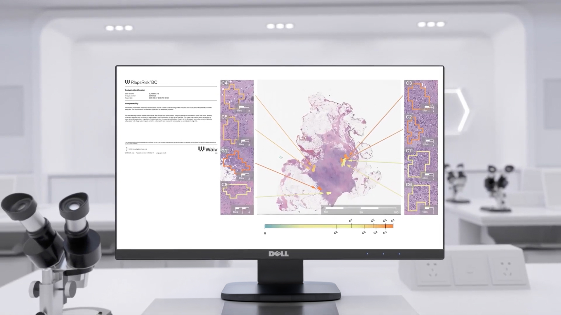 AI-analysed slide reviewed on a computer