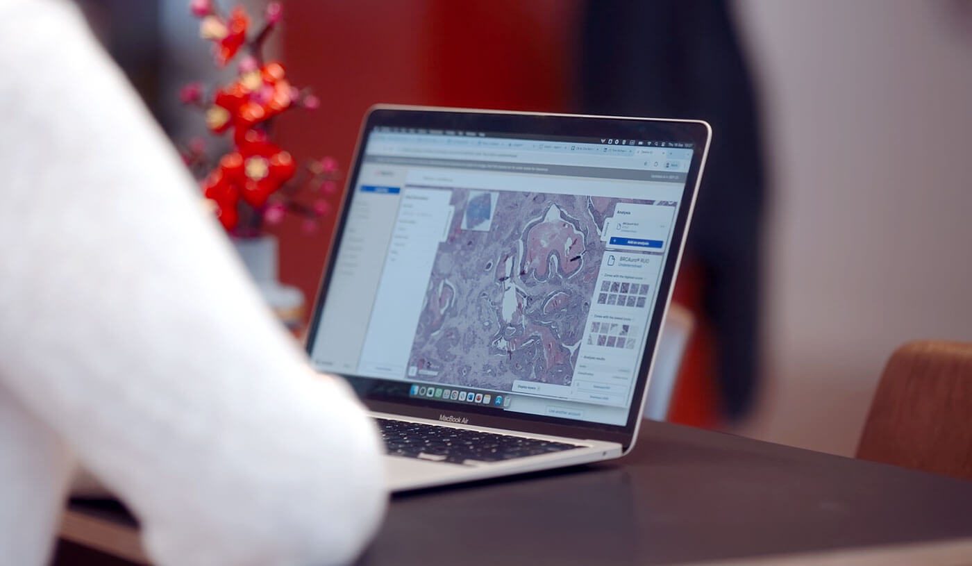 Pathologist reviewing a slide on screen