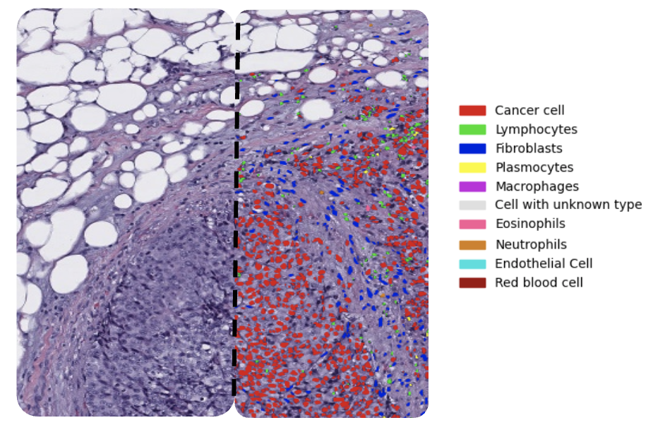 Waiv TME analysis platform quantifying cells and spatial patterns on a slide