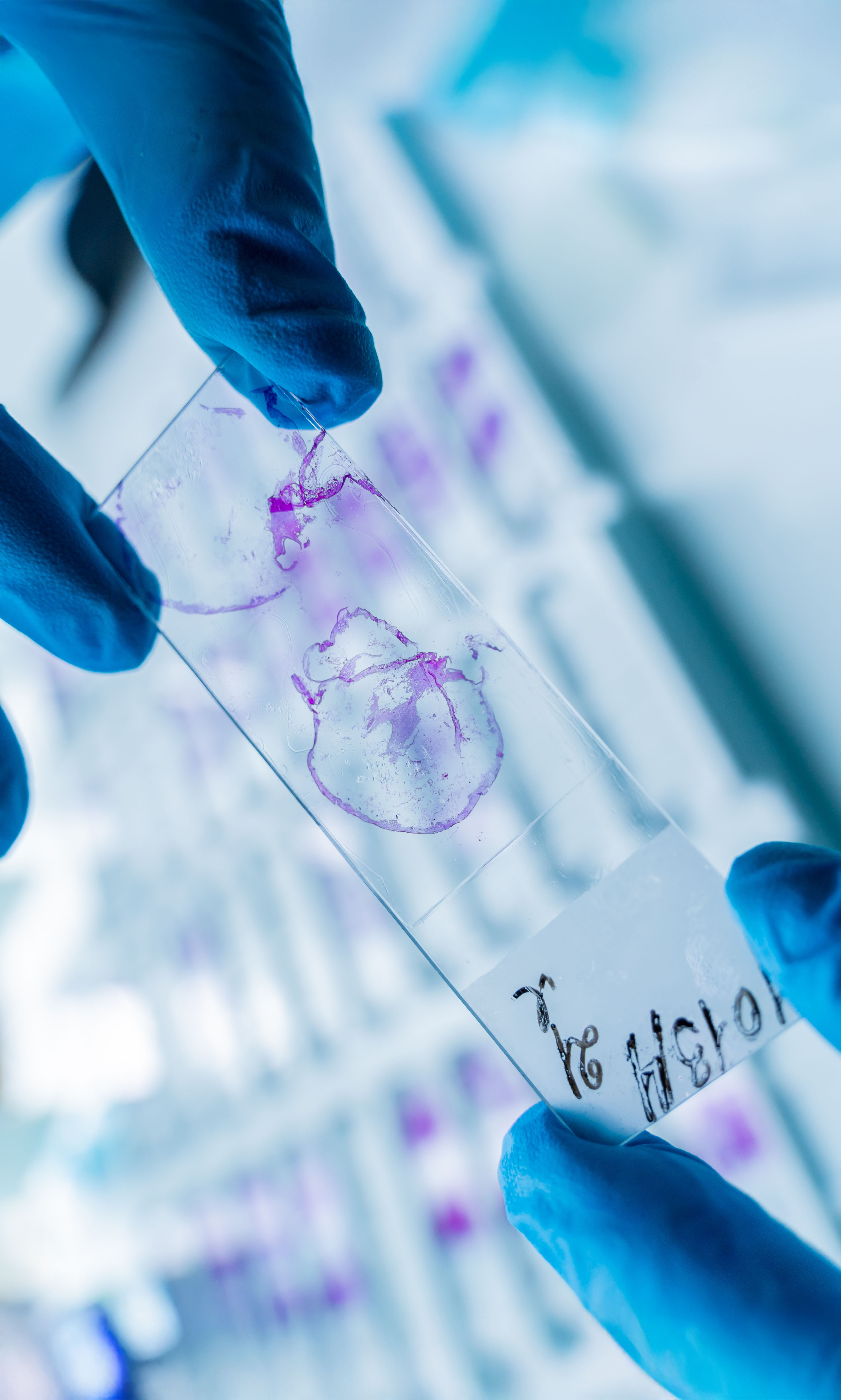 A gloved hand holding a stained H&E glass slide in the lab