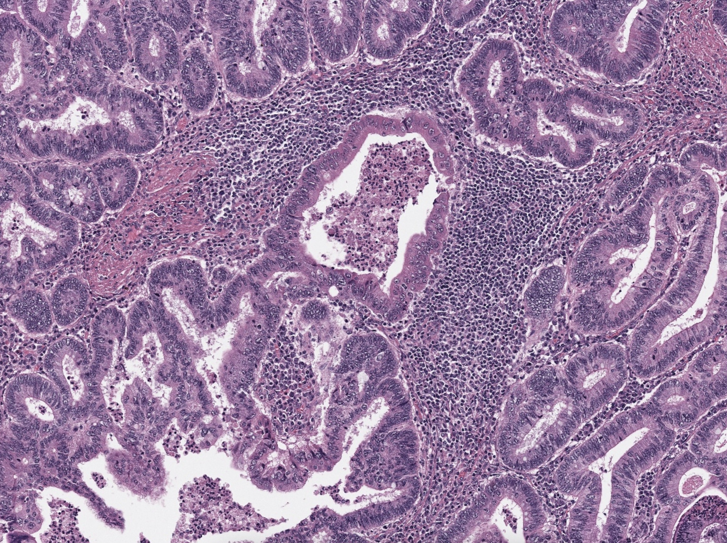 H&E stained tissue slide