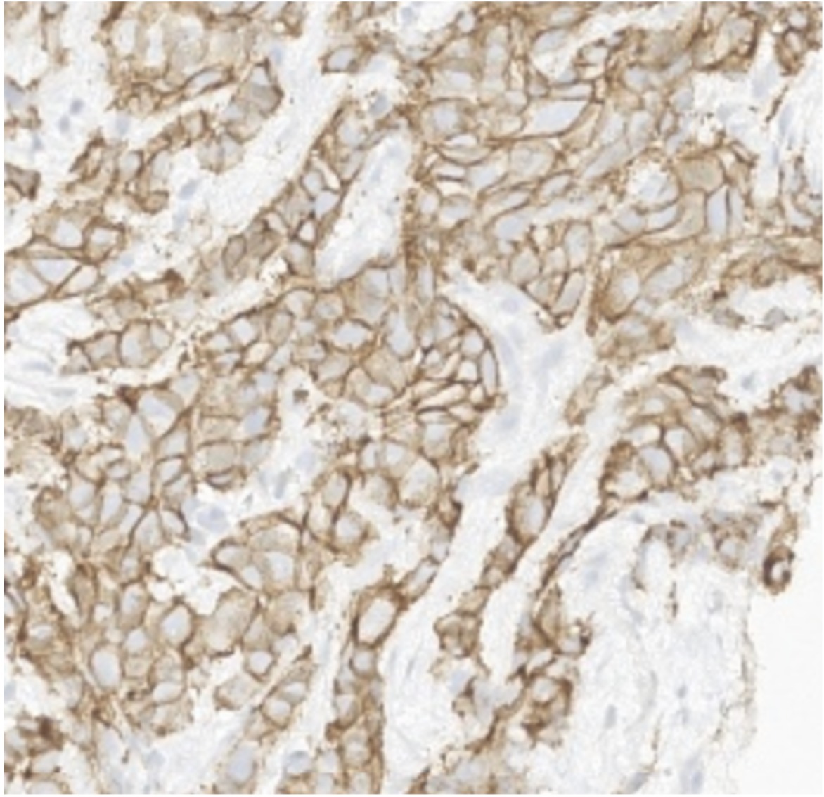 IHC stained tissue slide