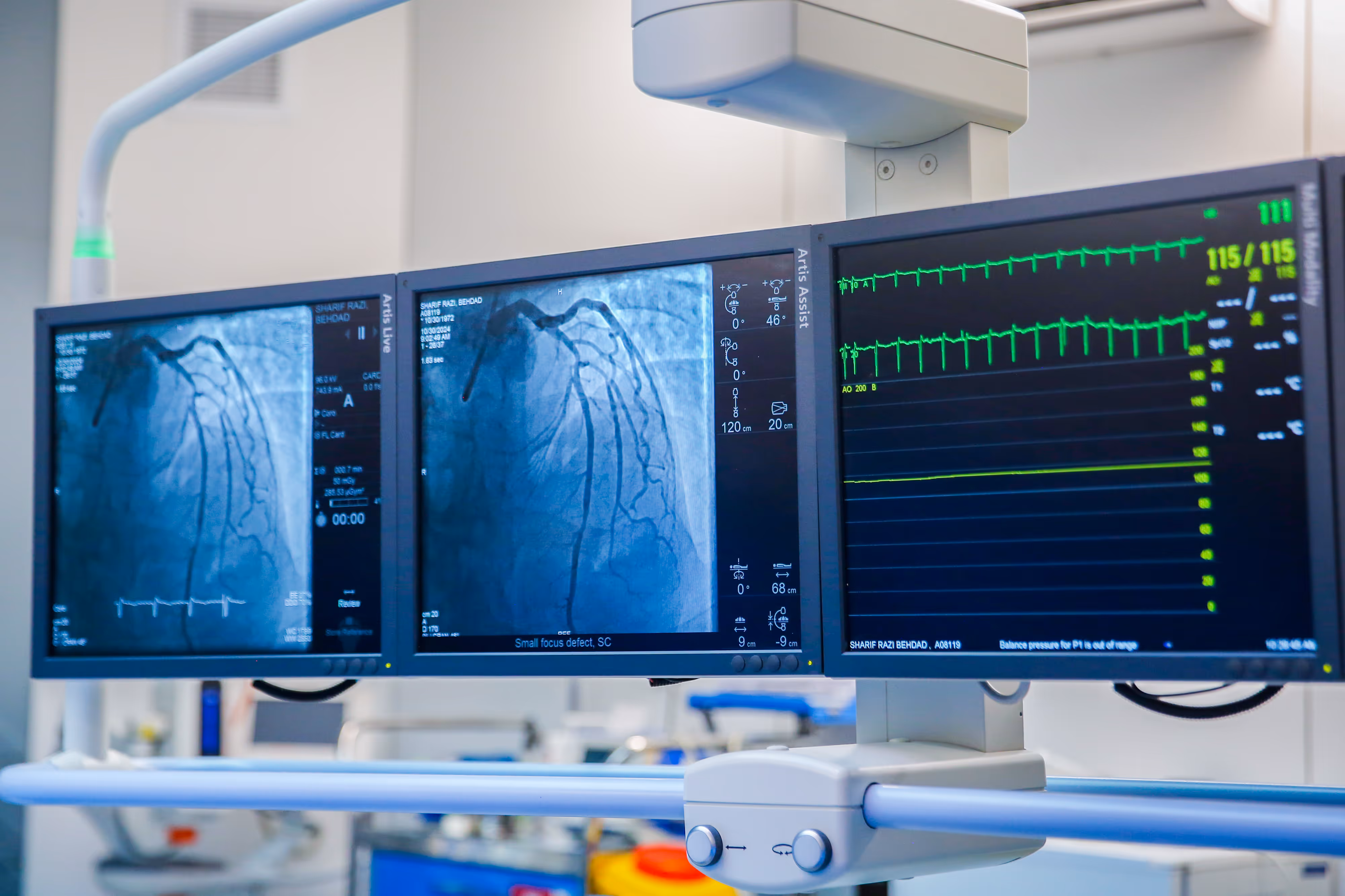 Three computer monitors with two on the left displaying radiology images and the third monitor displaying a patient's vitals.