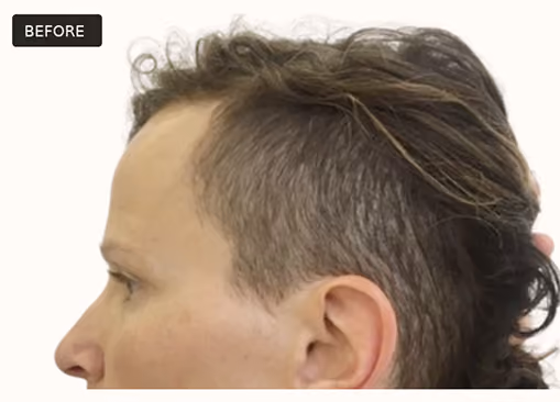 Side profile of a person's head with short, slightly tousled hair and trimmed sides, labeled 'BEFORE'.