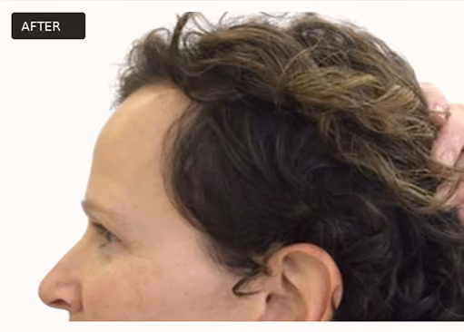 Side profile of a person with short, curly dark hair lifted to show hair volume, labeled 'AFTER' in top left corner.