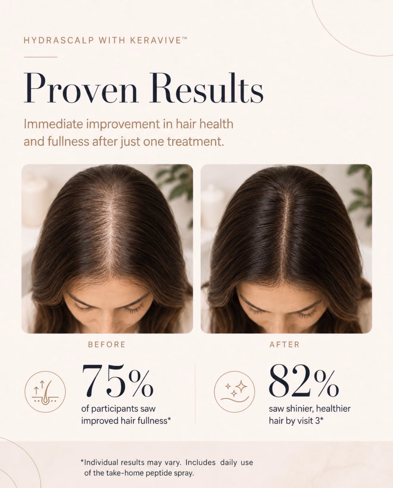 Comparison photos showing the top of a woman's head before and after one HydraScalp with KeraVive treatment, displaying improved hair fullness and health. The before photo shows thinning hair along the part, while the after photo shows visibly fuller, shinier hair. Text indicates 75% of participants saw improved hair fullness and 82% saw shinier, healthier hair after the treatment.