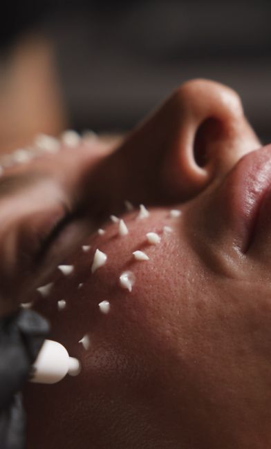 /can-stress-affect-your-skin-chandler-arizona