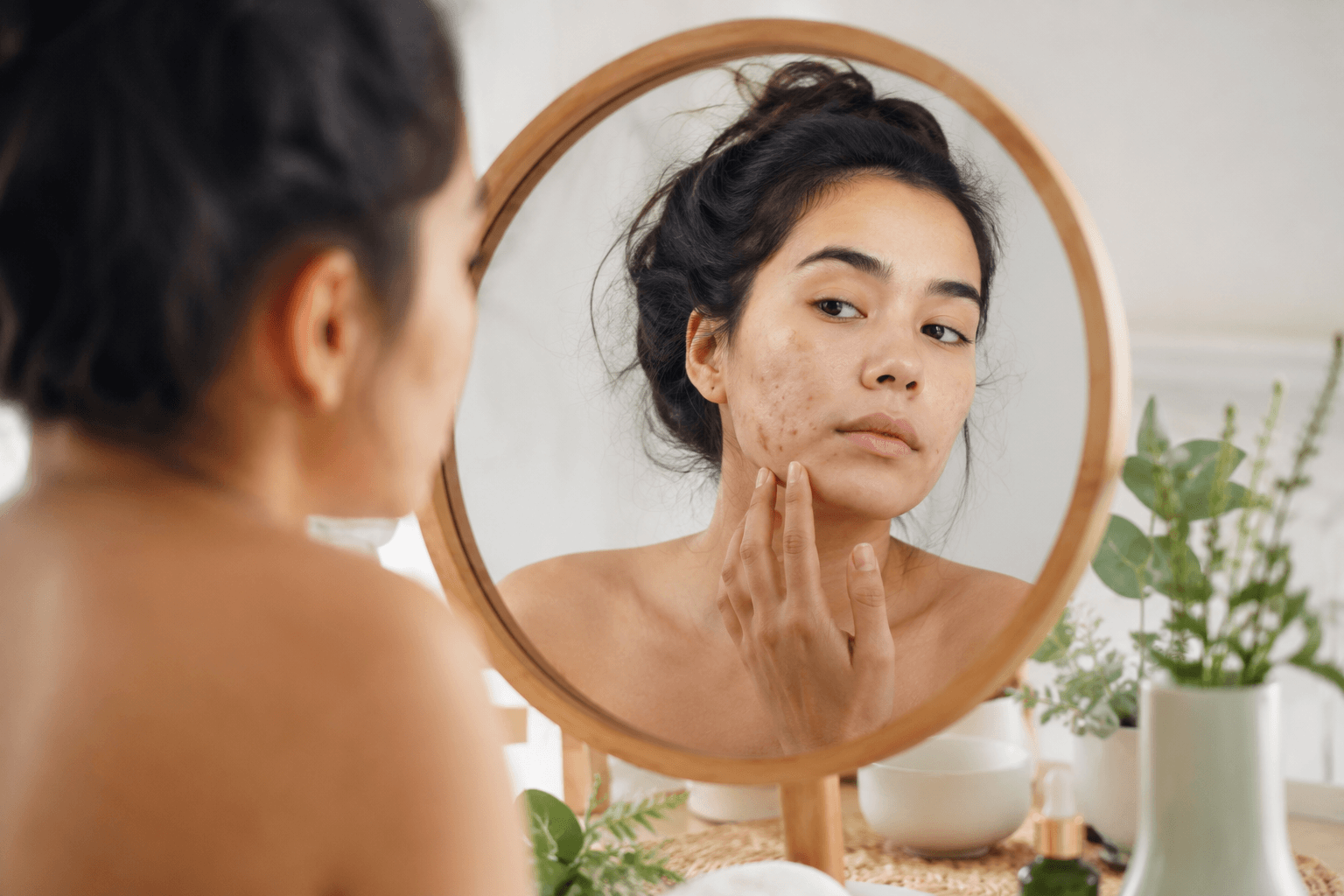 Woman in Chandler, Arizona receiving a holistic acne healing facial with gua sha tools to improve skin texture and reduce post-acne marks