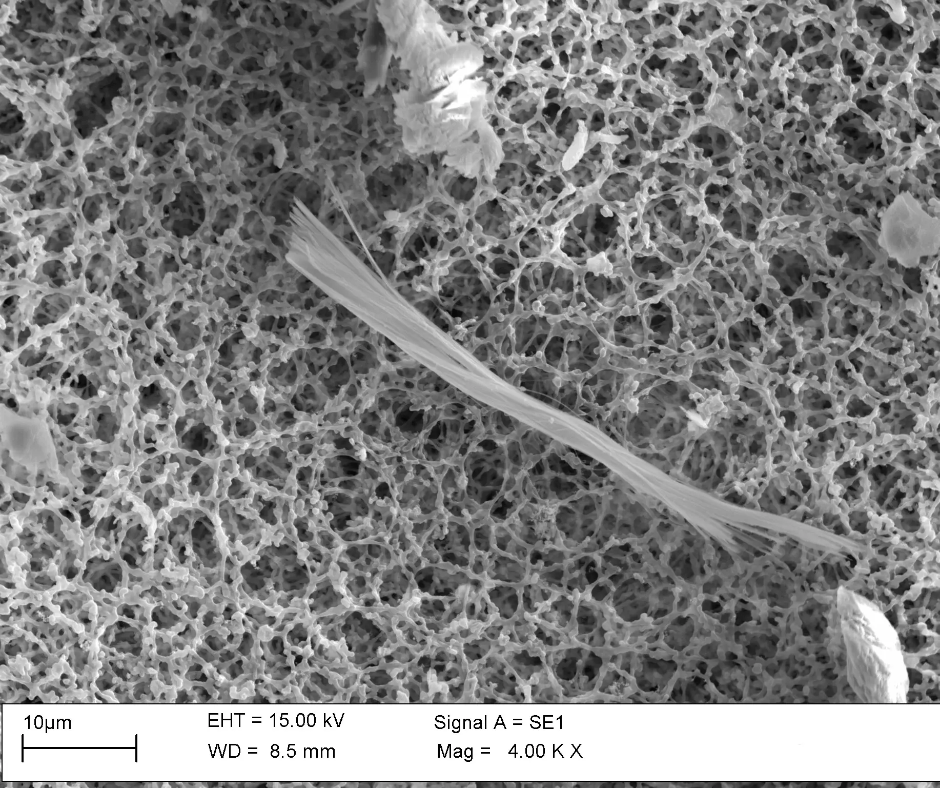 Fascio di fibre di crisotilo ed alcuni corpuscoli su membrana porosa a maglie irregolari visto al microscopio elettronico