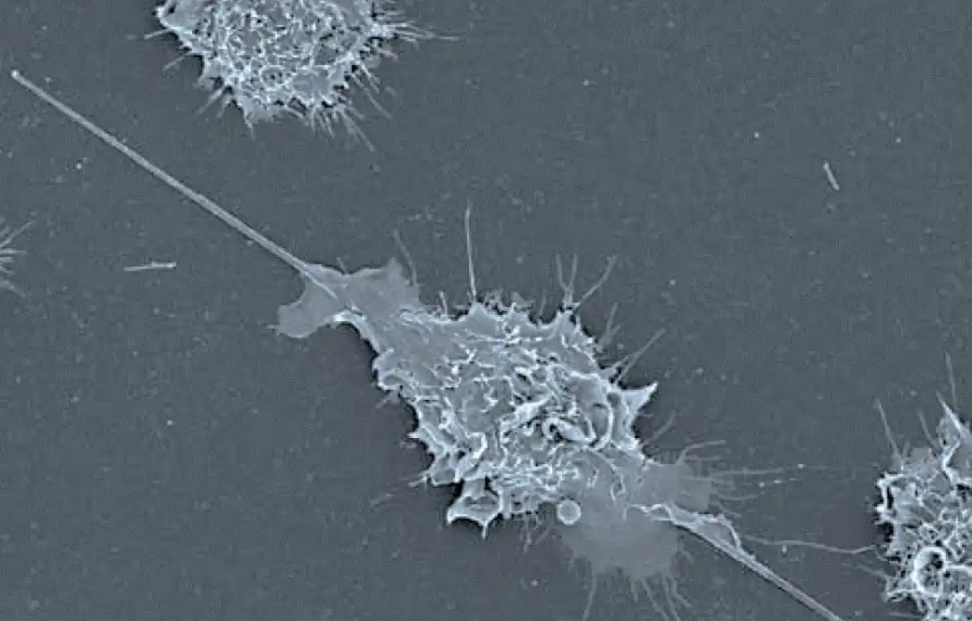 Foto al microscopio elettronico di macrofagi che stanno tentando di fagocitare delle fibre