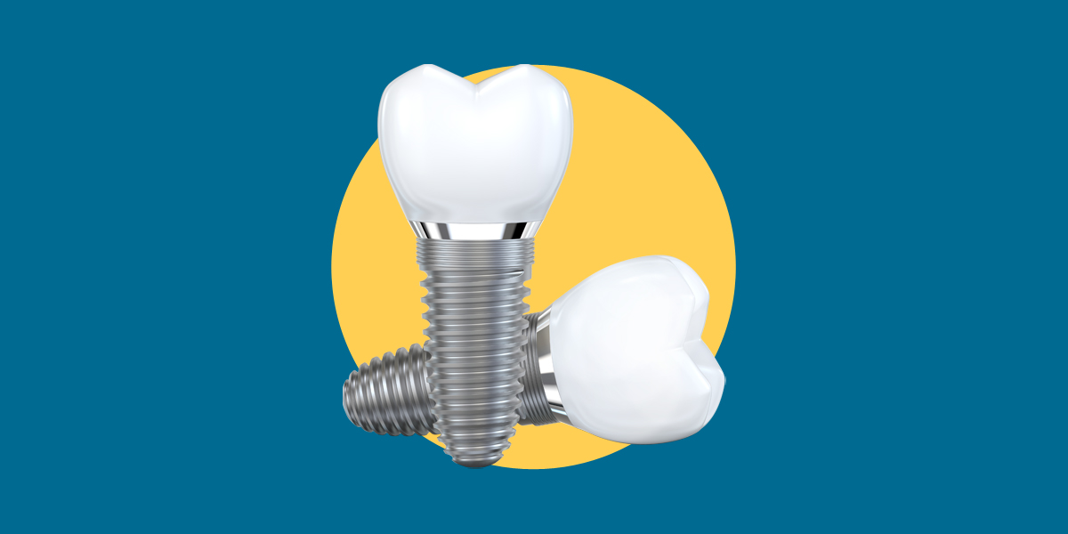 Regulatory Updates for Implant Products in September 2021 by CMDE