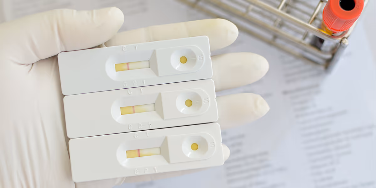 IVD reagent registration change review draft guidelines