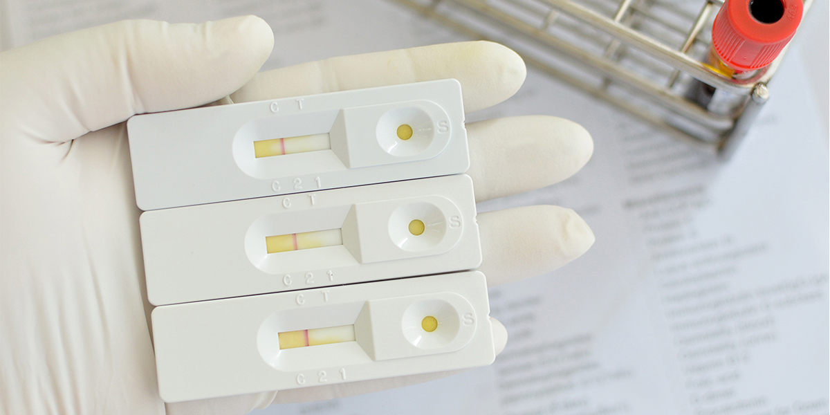 IVD reagent registration change review draft guidelines