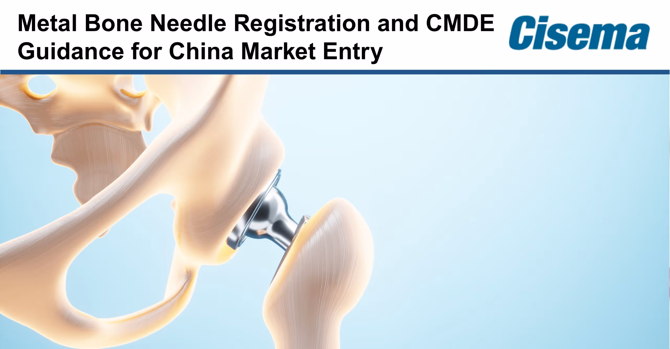 Metal Bone Needle Registration and CMDE Guidance for China Market Entry