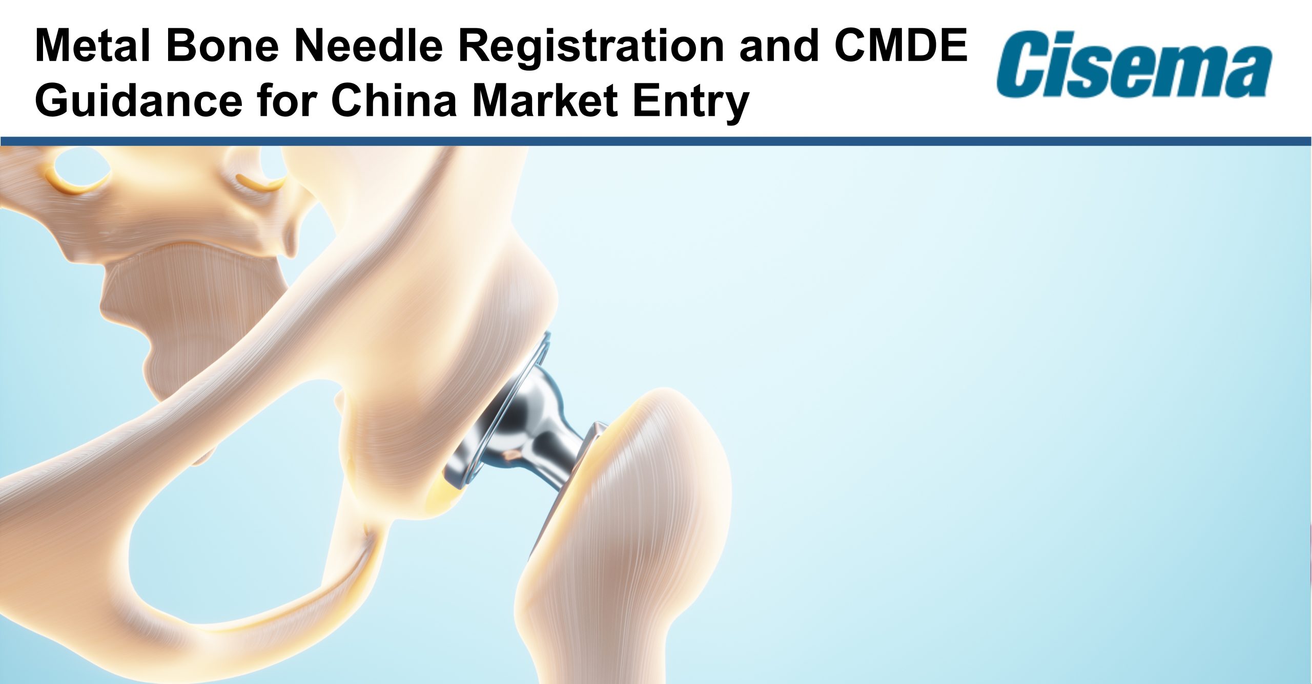 Metal Bone Needle Registration and CMDE Guidance for China Market Entry