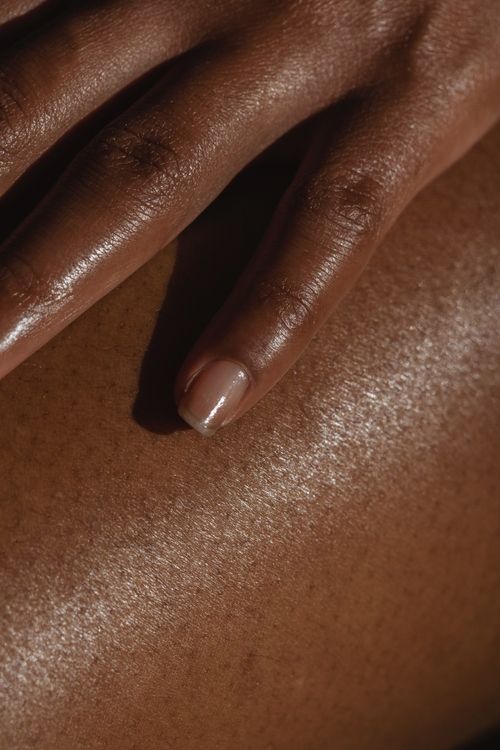Laser Hair Removal Aftercare In NYC: What To Do After Treatment