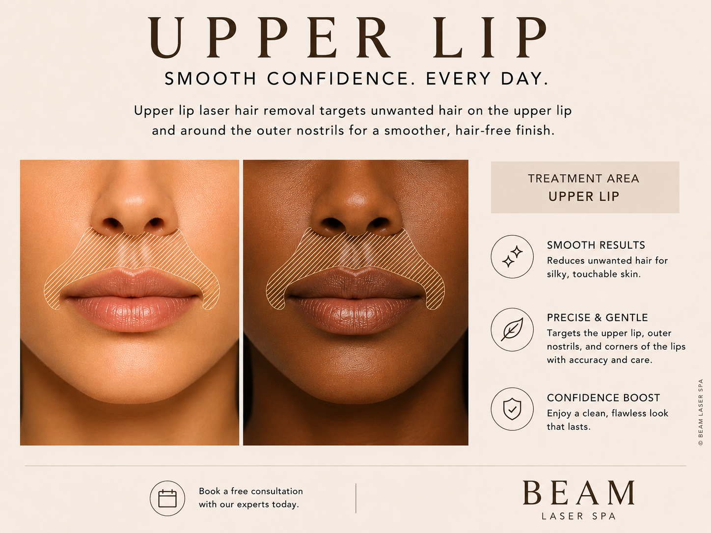 Upper Lip