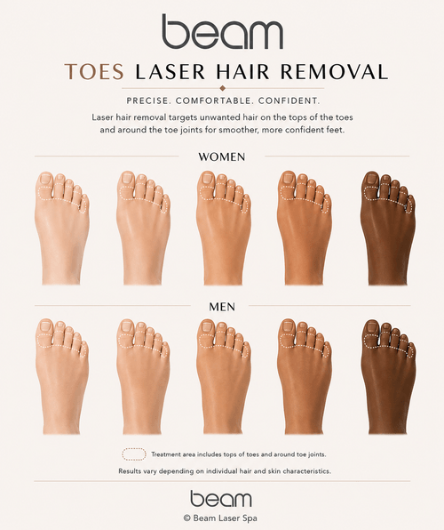Toe laser hair removal treatment areas illustrated on diverse male and female skin tones, showing the tops of the toes and toe joints treated at Beam Laser Spa NYC