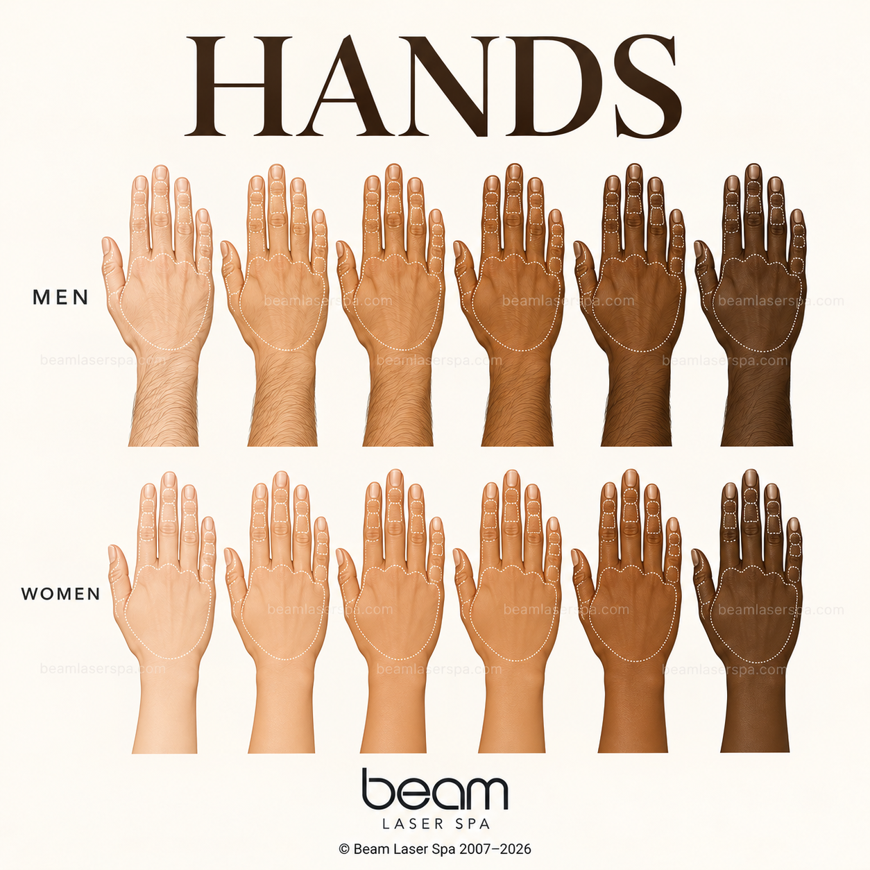 Hand Laser Hair Removal