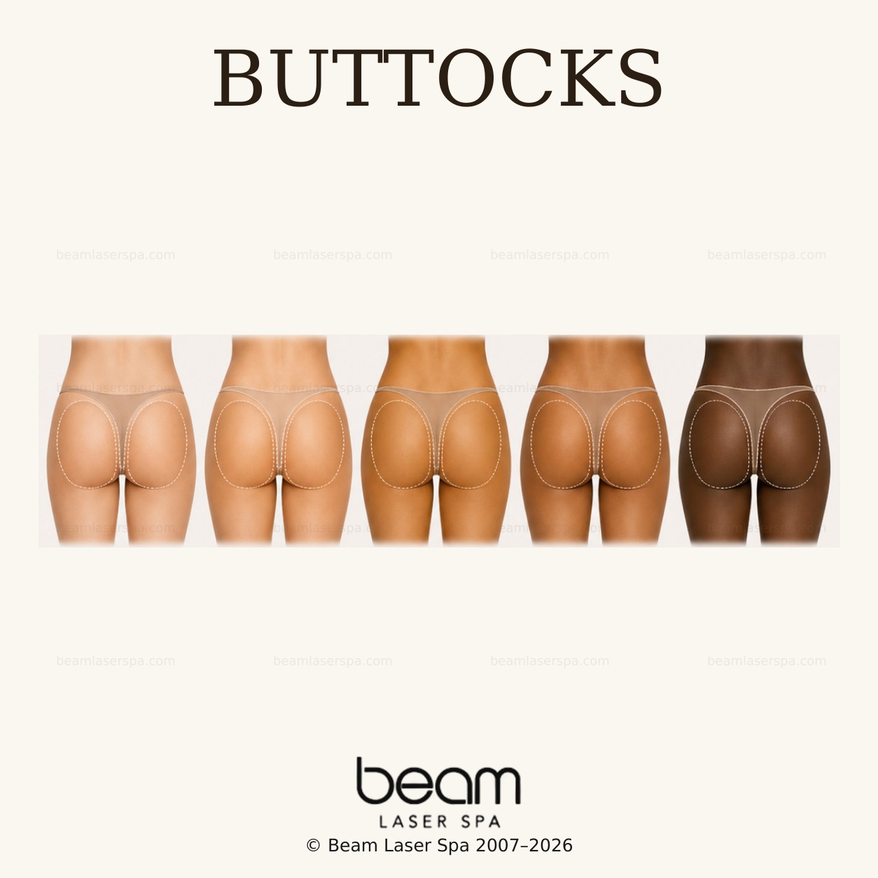 Buttocks Laser Hair Removal