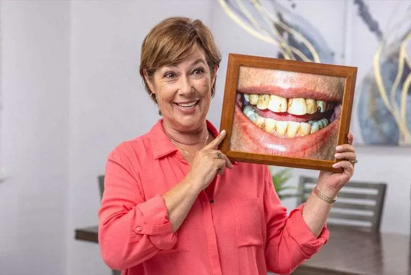 Testimonial from susan to kissimmee about dental implants