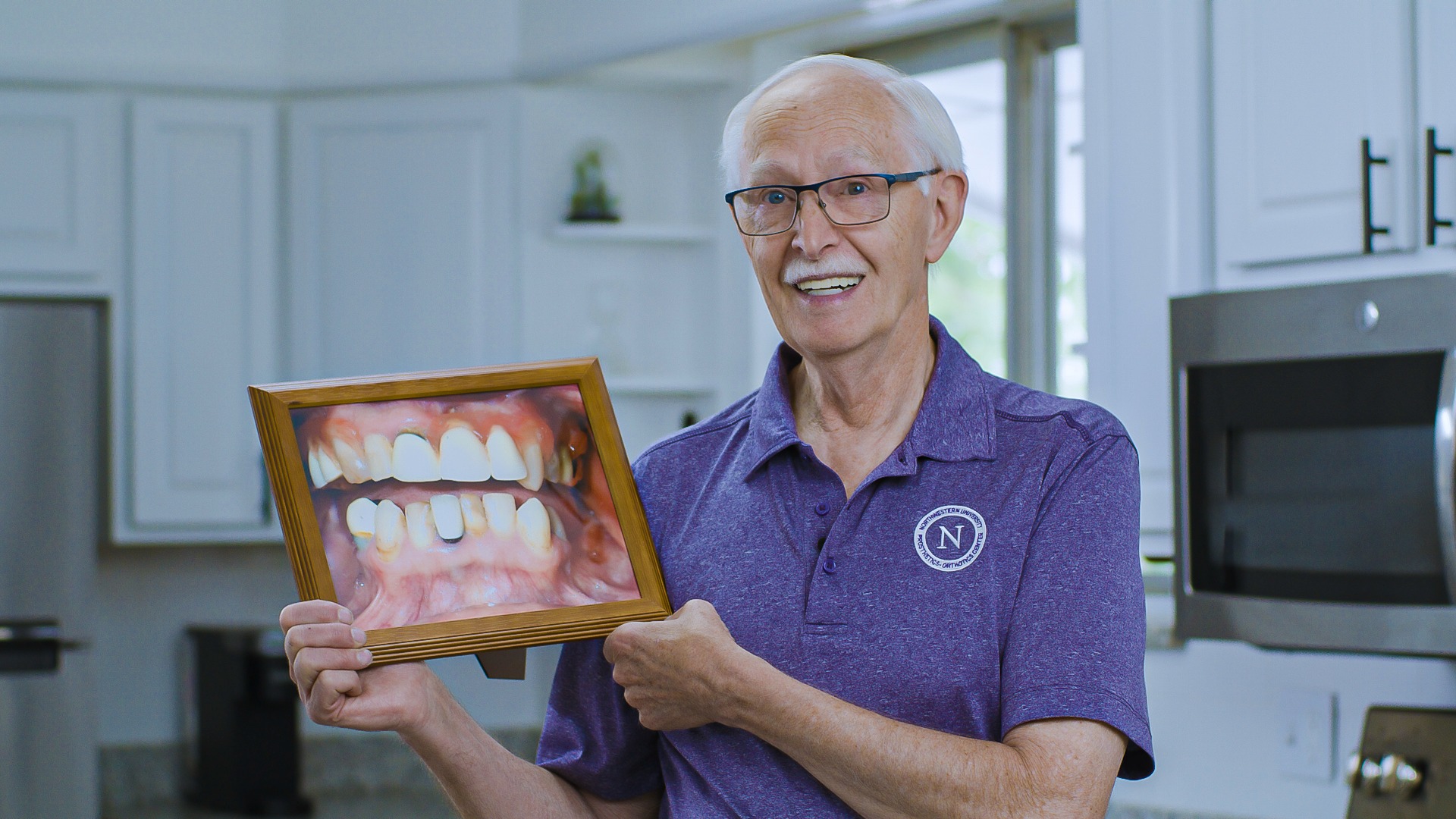 Wick holding a photo of his teeth before treatment