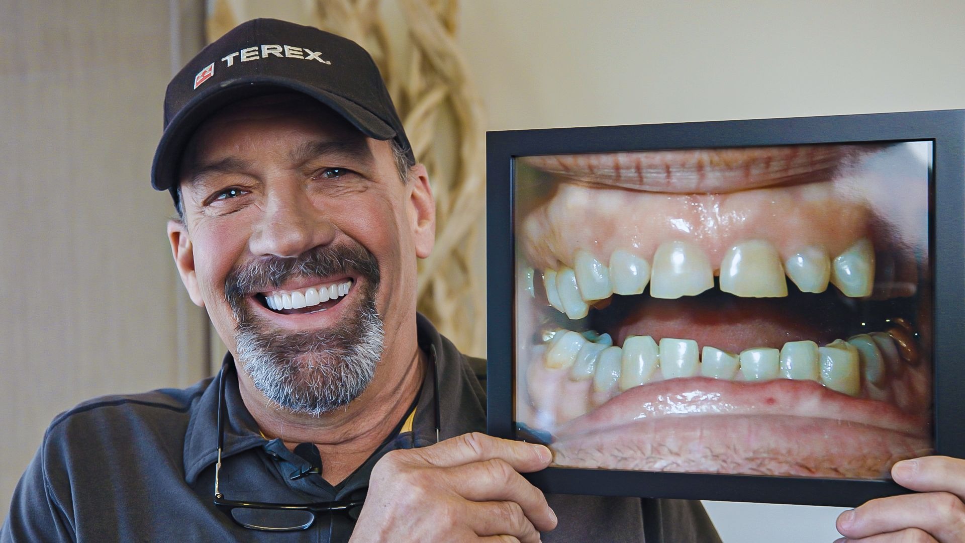 Dental implant patient smiling while holding a photo of his teeth before treatment