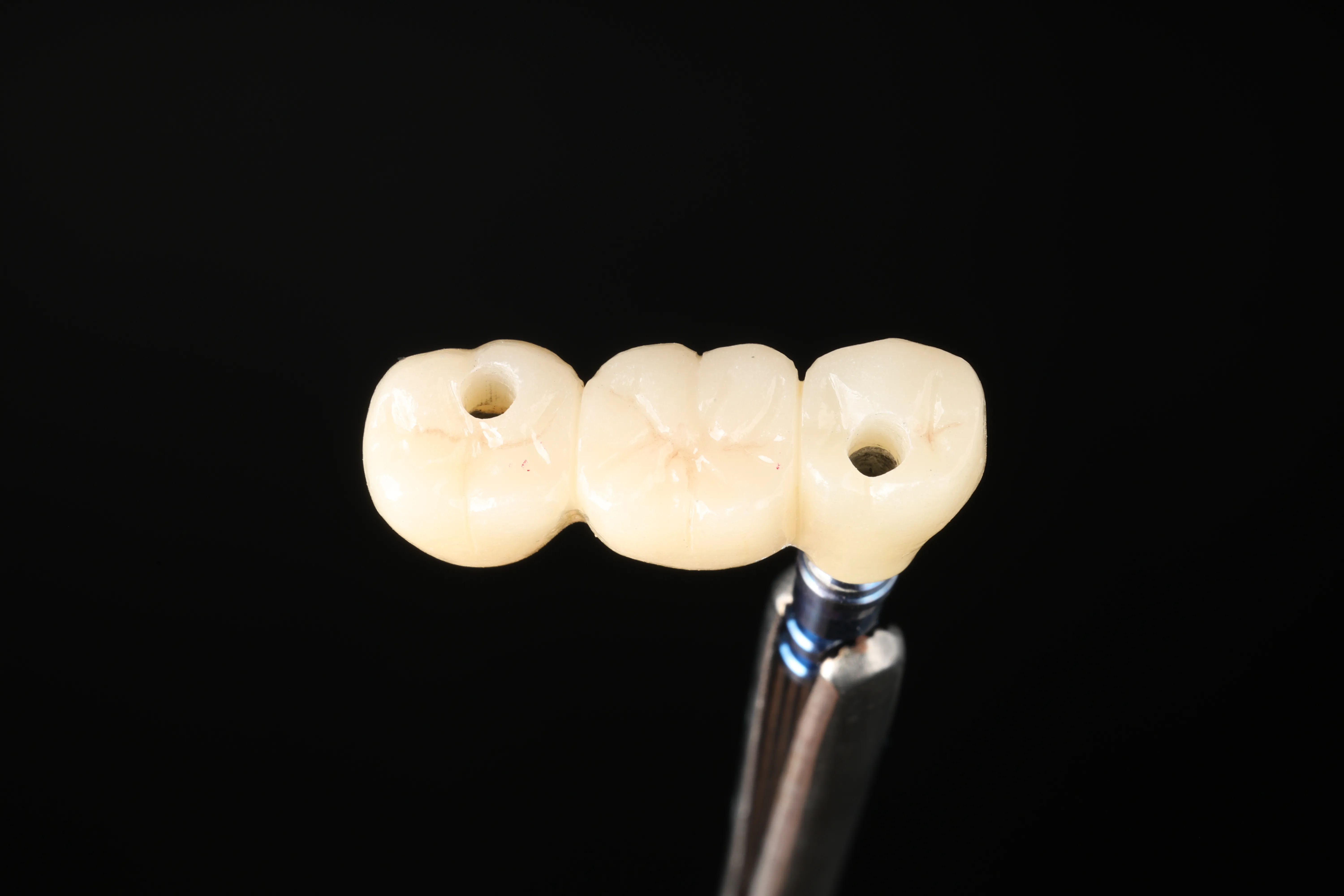 Three-unit implant-supported dental bridge on a holder