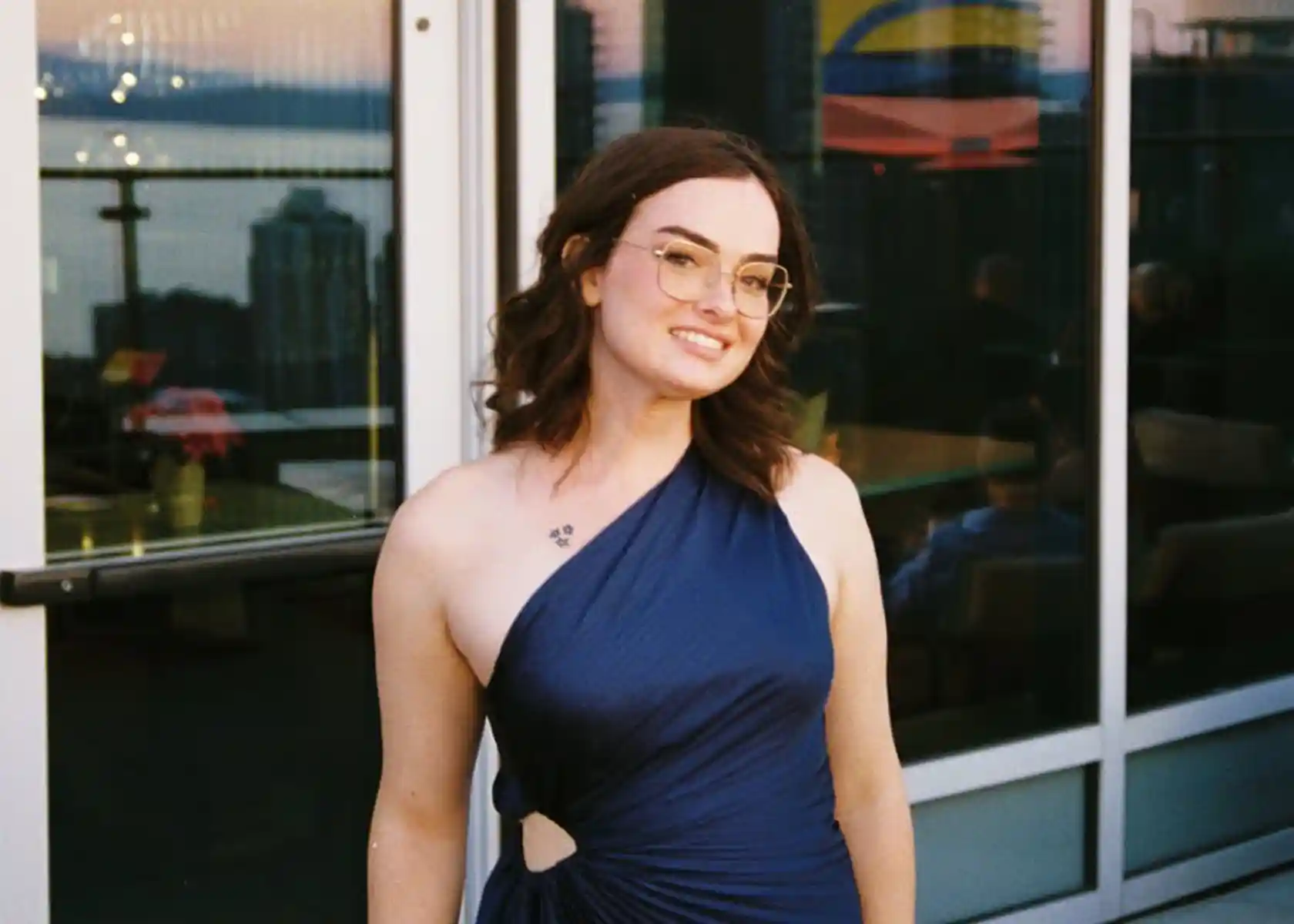 Comprehensive facial softening with forehead shortening, orbital and frontal remodeling, brow lift, chin fat grafting, and jaw contouring. The outcome is very natural.