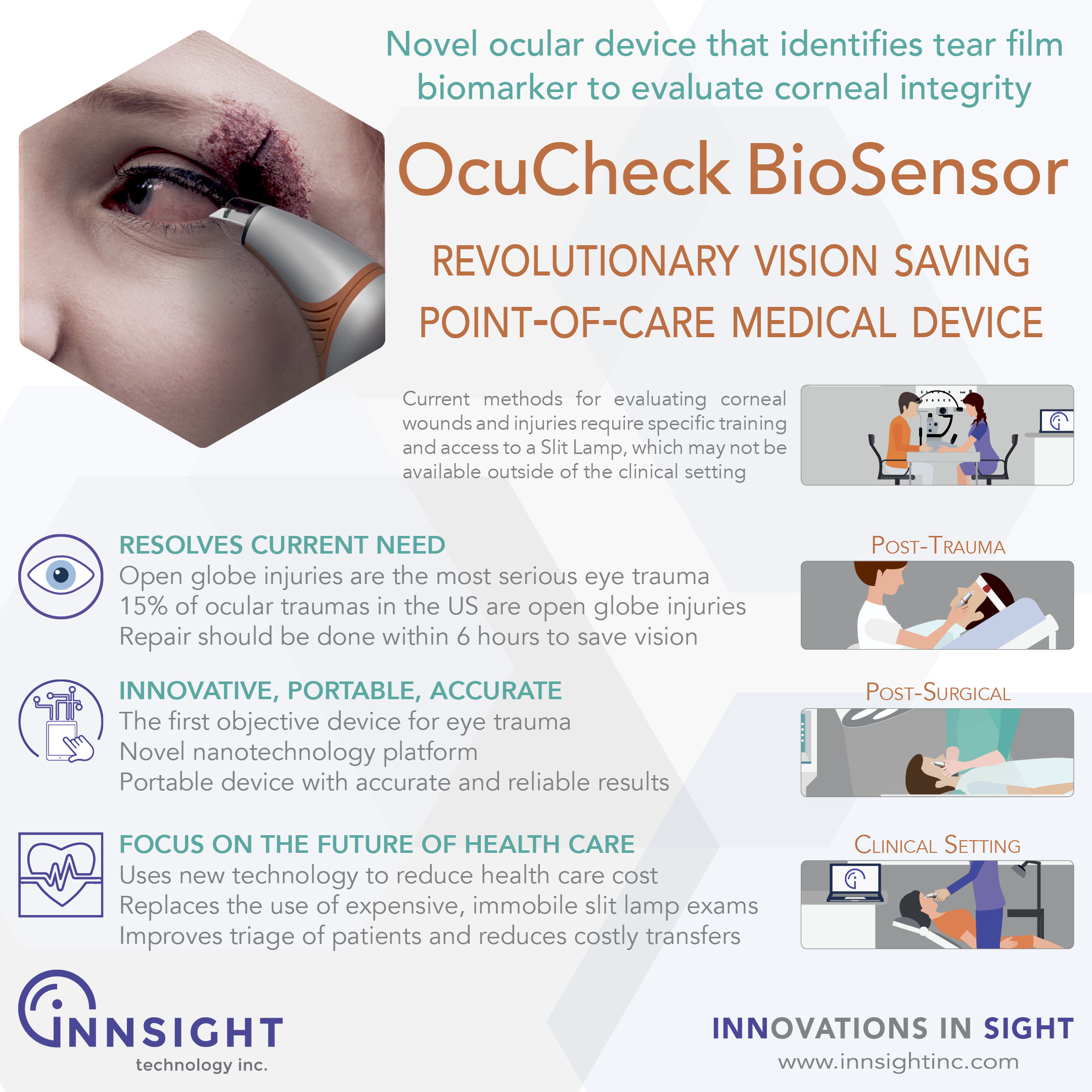 Poster showcasing OcuCheck BioSensor, a portable medical device for evaluating corneal integrity and eye trauma using a tear film biomarker, highlighting its innovative, accurate, and cost-reducing technology for post-trauma, post-surgical, and clinical settings.