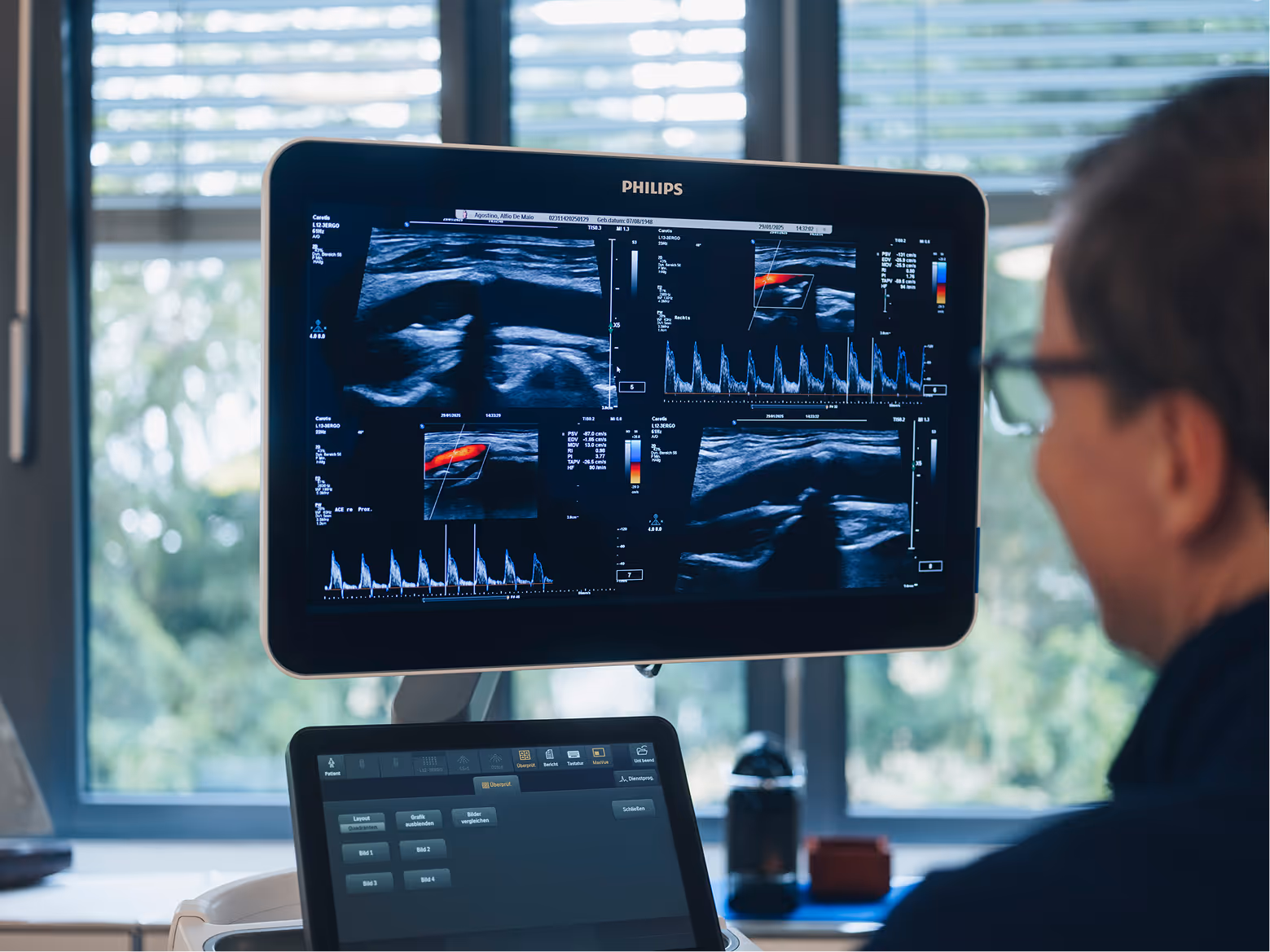 Medical professional viewing ultrasound images with blood flow and waveform data on a Philips monitor in a clinical setting.