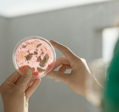 Gut Microbiome Analysis