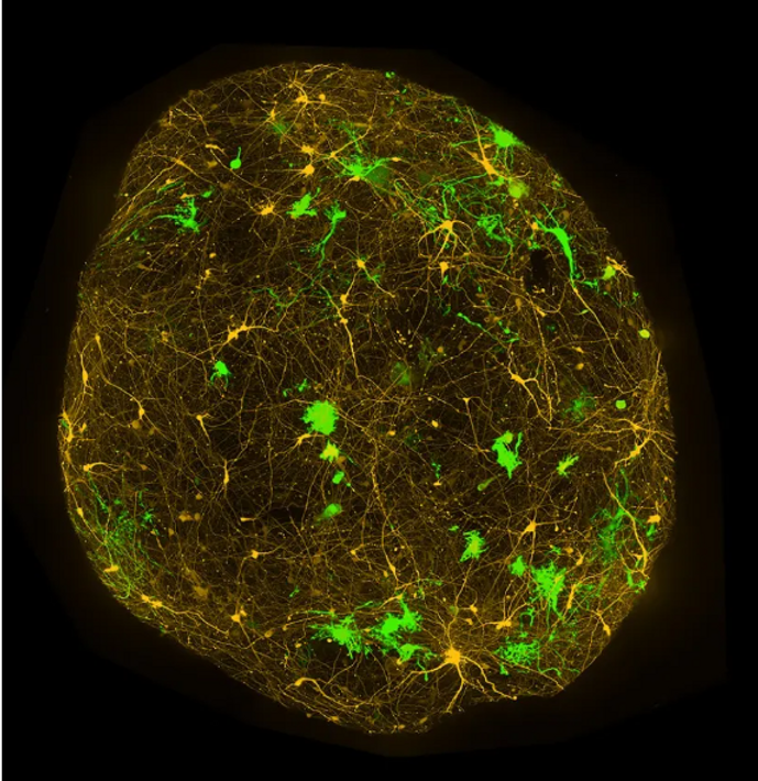 organoid for drug discovery