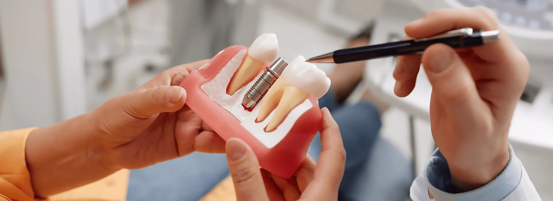 The best dentist in Leander for dental implants uses a model of the teeth to explain how dental implants replace missing teeth