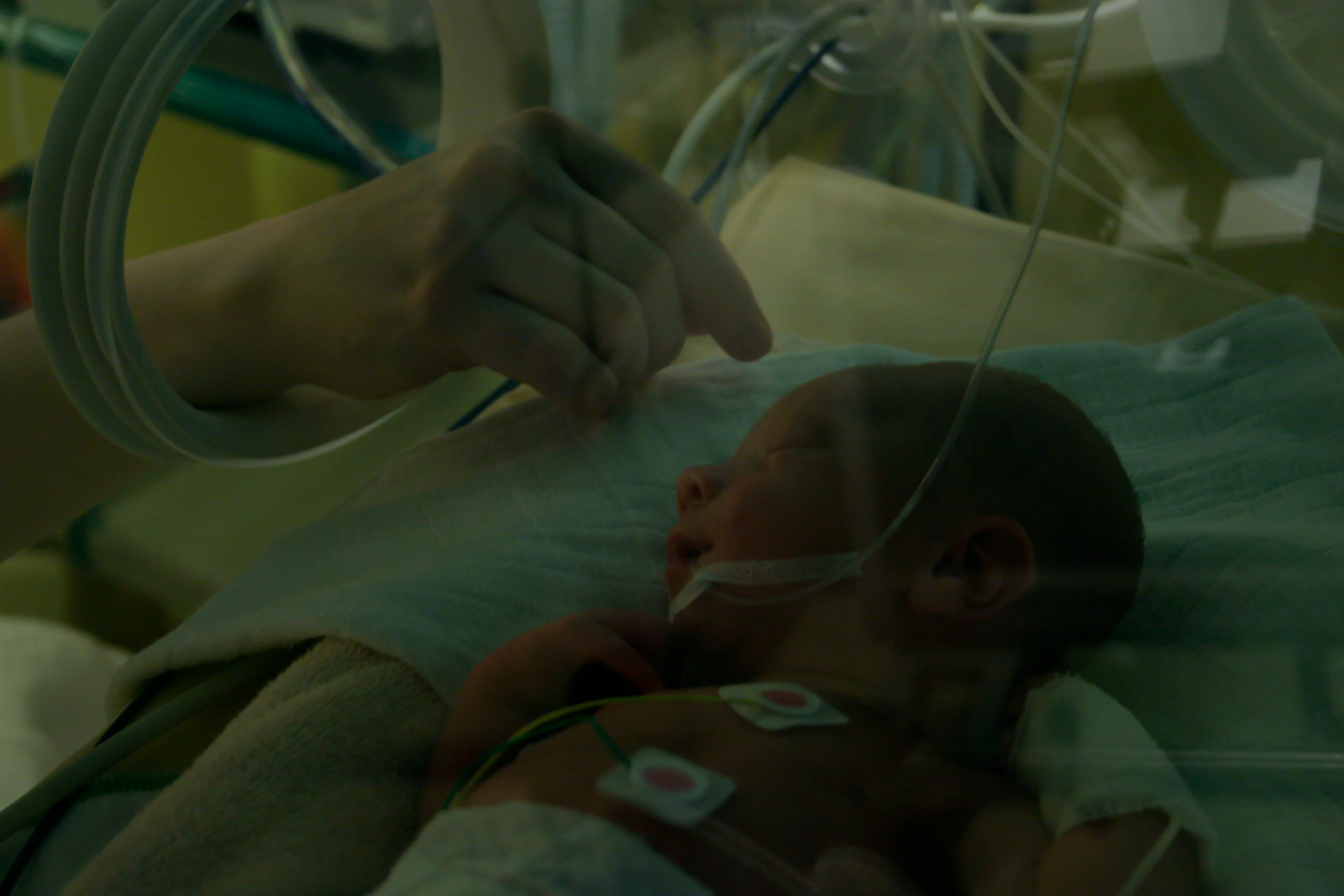 Nejvyšší soud: Pobyt rodiče ve zdravotnickém zařízení s hospitalizovaným dítětem má své hranice