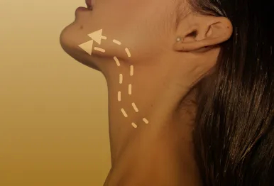 Neck Lift