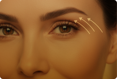 Eye lifting