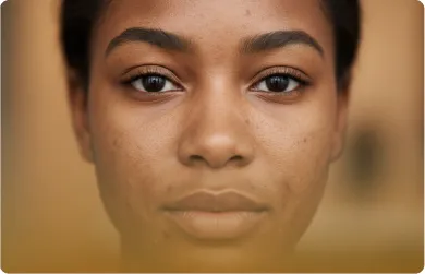 Skin texture
