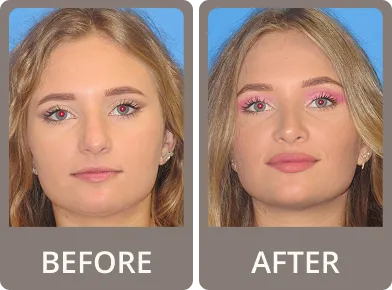 Before and after photos of a woman showing subtle nose reshaping and enhanced pink makeup on eyes and lips.