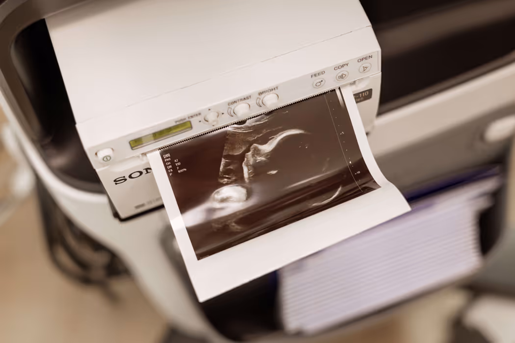 Een sondeerapparaat print een echografieafbeelding van een foetus uit.