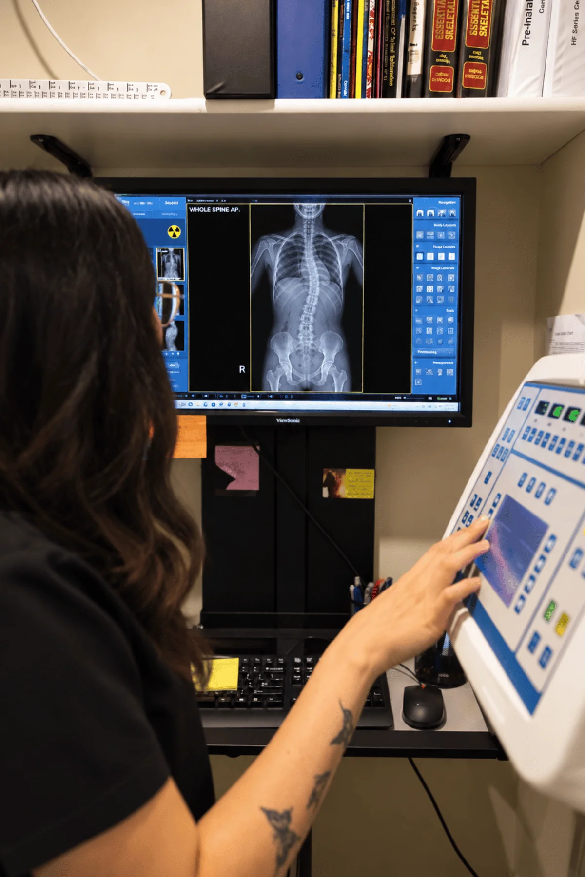 Team member reviewing a digital full spine X-ray on a monitor at In Line Family Chiropractic