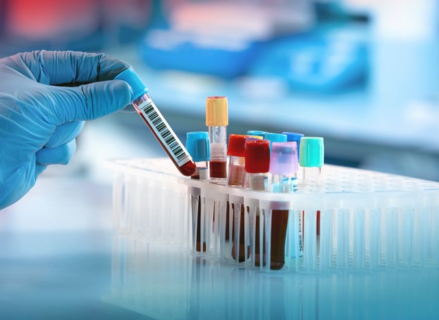 test bottle being removed from test tube holder
