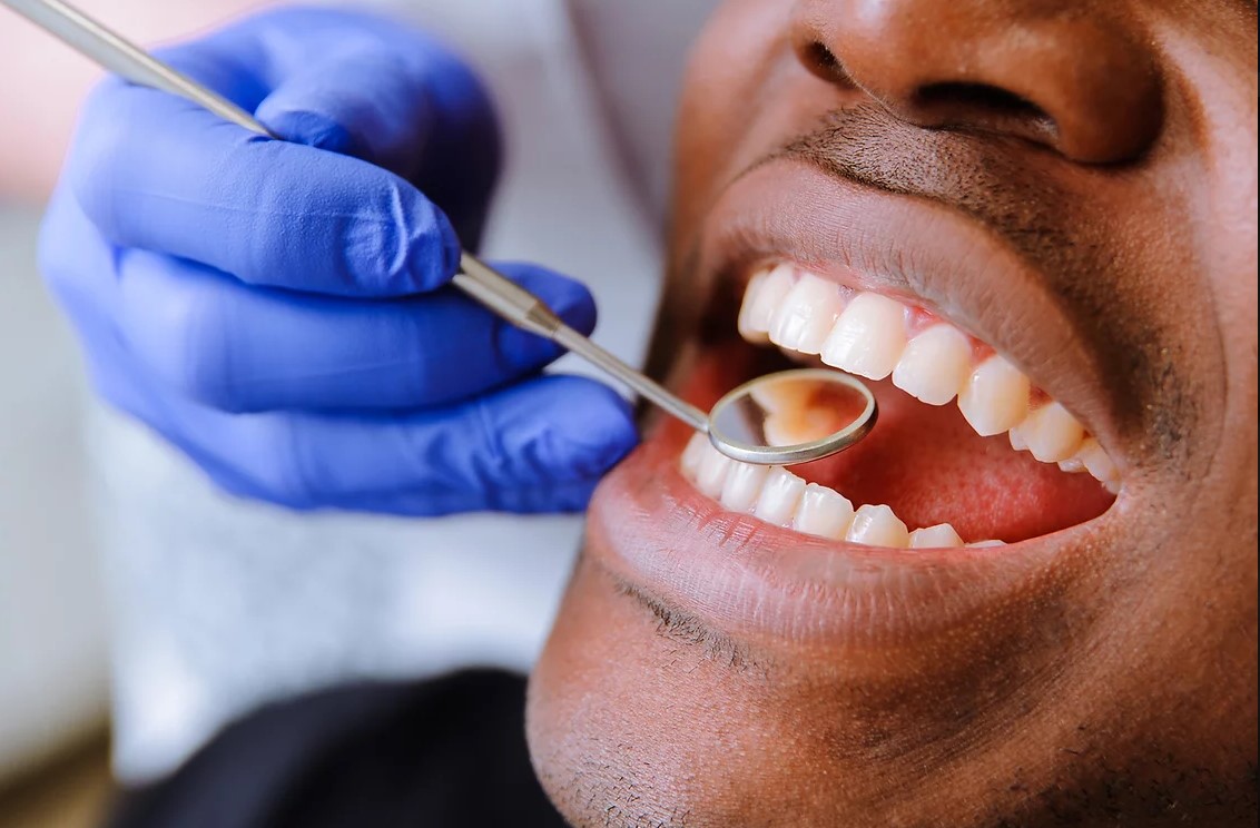 teeth being examined with small dental mirror