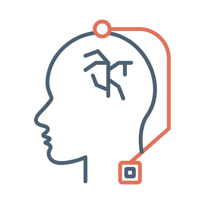 Deep brain stimulation illustration