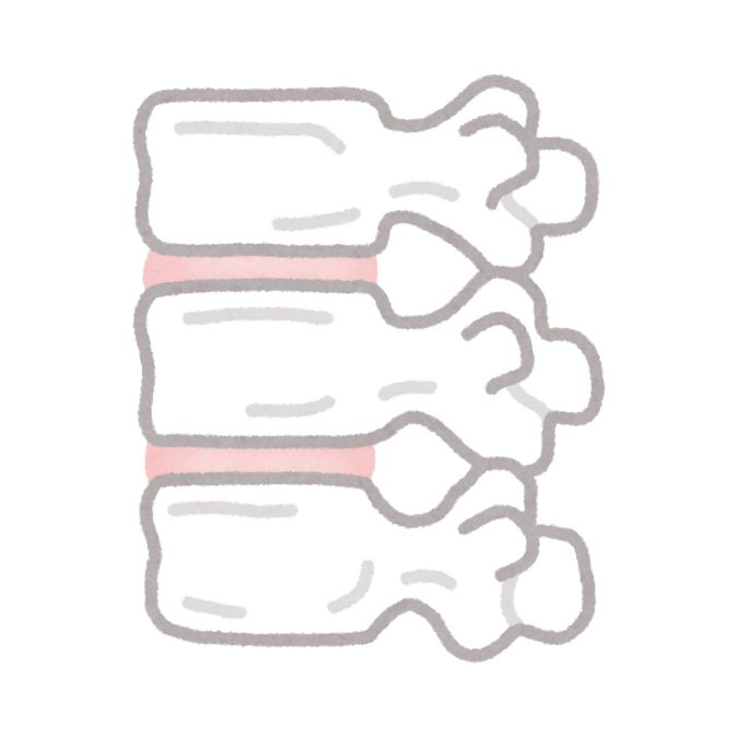 illustration of spinal sx