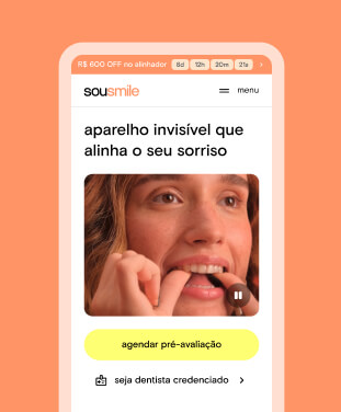 Mobile interface of SouSmile offering an invisible teeth aligner with a countdown timer and a photo of a woman inserting the aligner.