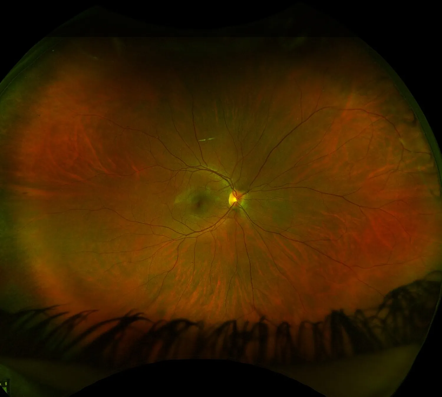 Optomap retinal imaging scan showing detailed view of eye health and blood vessels for early disease detection