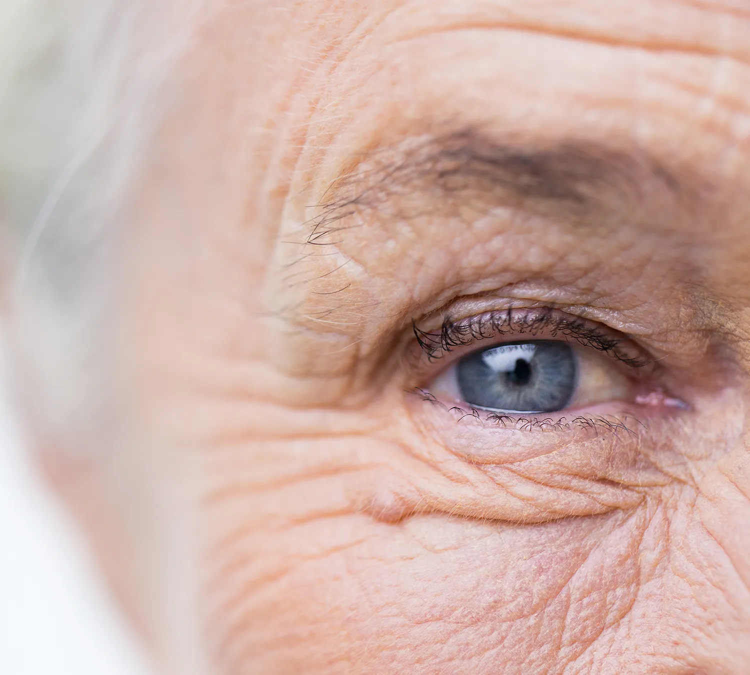 Close-up of senior eye showing dry eye symptoms requiring professional optometry treatment